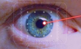 Are you awake during LASIK? 2024 Update 