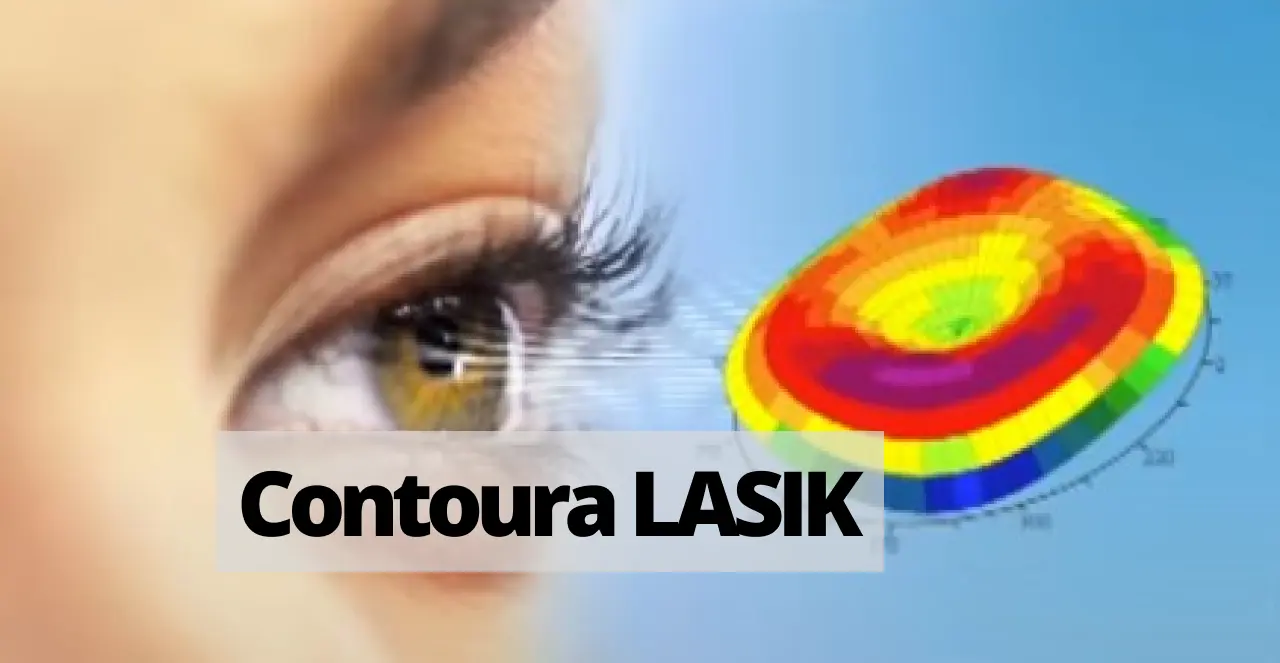 Contoura LASIK procedure