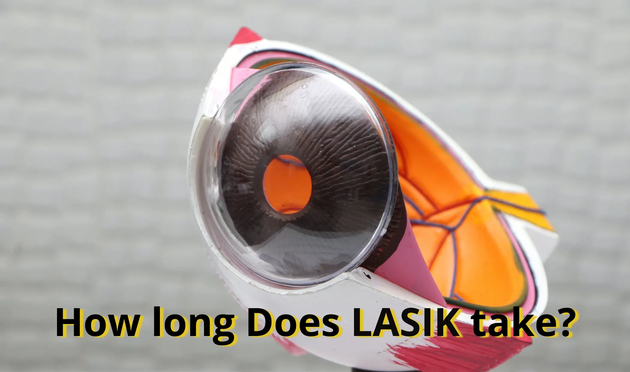 How long does LASIK take?